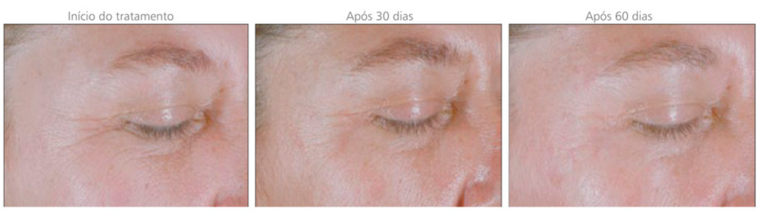 Biolumen, laser em creme, Cientifique