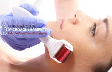 Microagulhamento, Cientifique