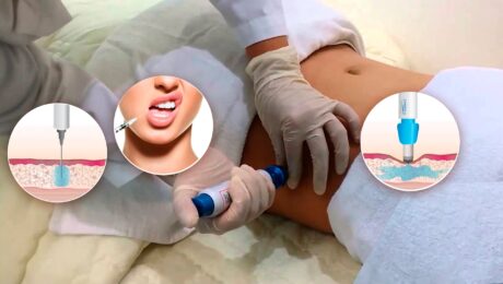 INTRADERMOTERAPIA PRESSURIZADA, tratamento revolucionário para disfunções estéticas