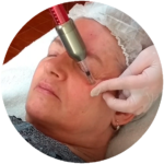 Intradermo Pressurizada Facial, Cientifique