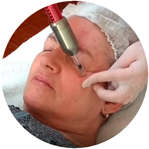 Intradermo Pressurizada Facial, Cientifique